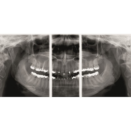 KaVo Pan eXam Plus 2D - датчик для панорамной рентгенодиагностики