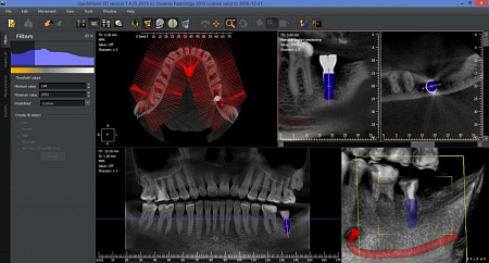 Owandy I-Max Touch 3D – Конусно-лучевой томограф 9х8