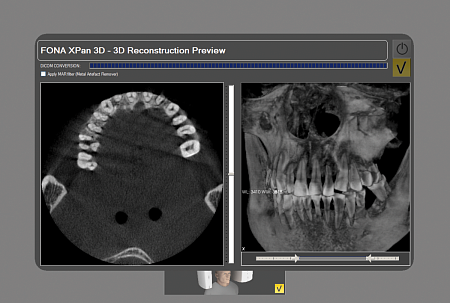 FONA XPan 3D - рентгенографическая цифровая система панорамной съемки